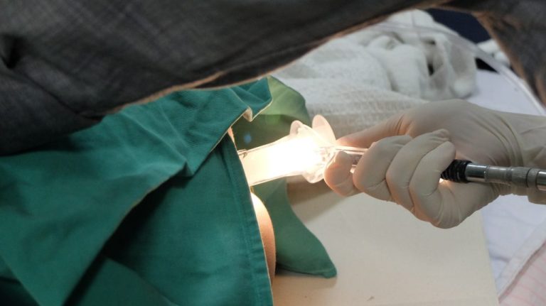 Haemorrhoids Surgery Singapore for Severe or Recurring Cases