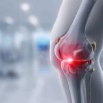 Treatment Options Available at a Sports Injuries Clinic for Knee Injuries