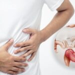 Colonoscopy Findings Explained: What Your Colon Specialist Singapore May Recommend Next